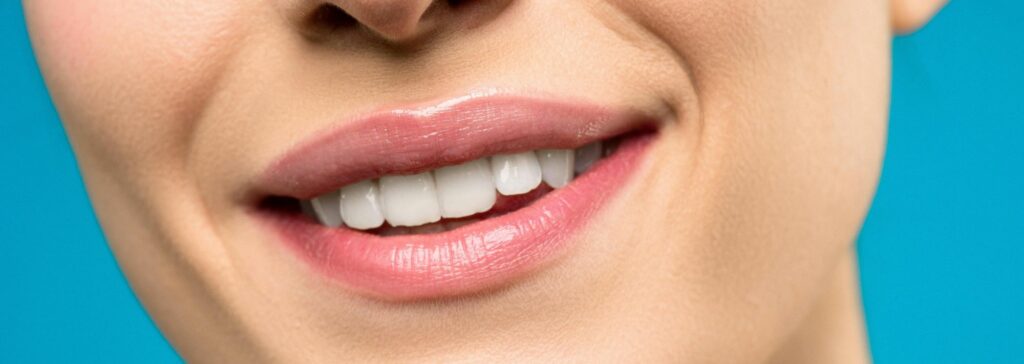 clear aligners