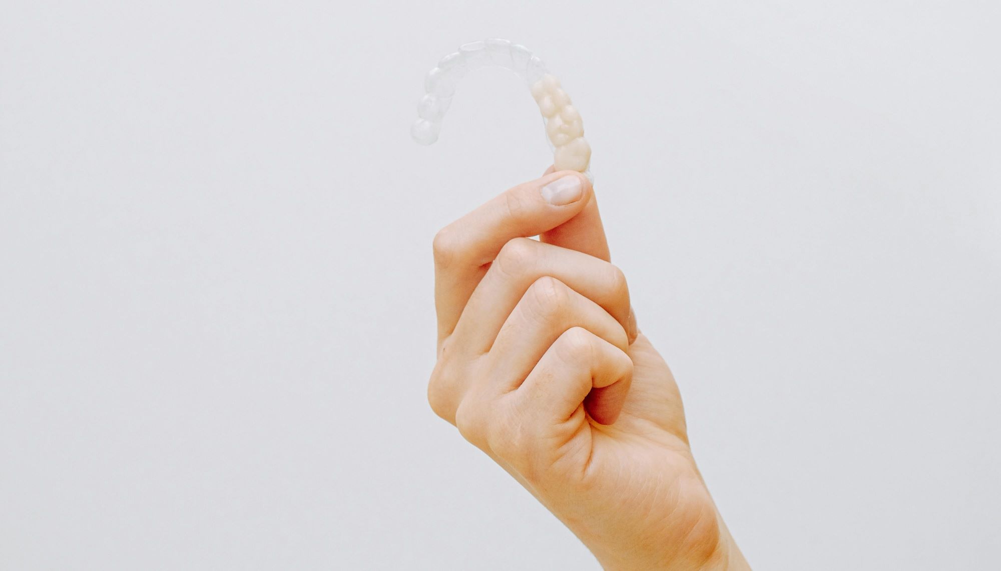 clear aligners versus braces