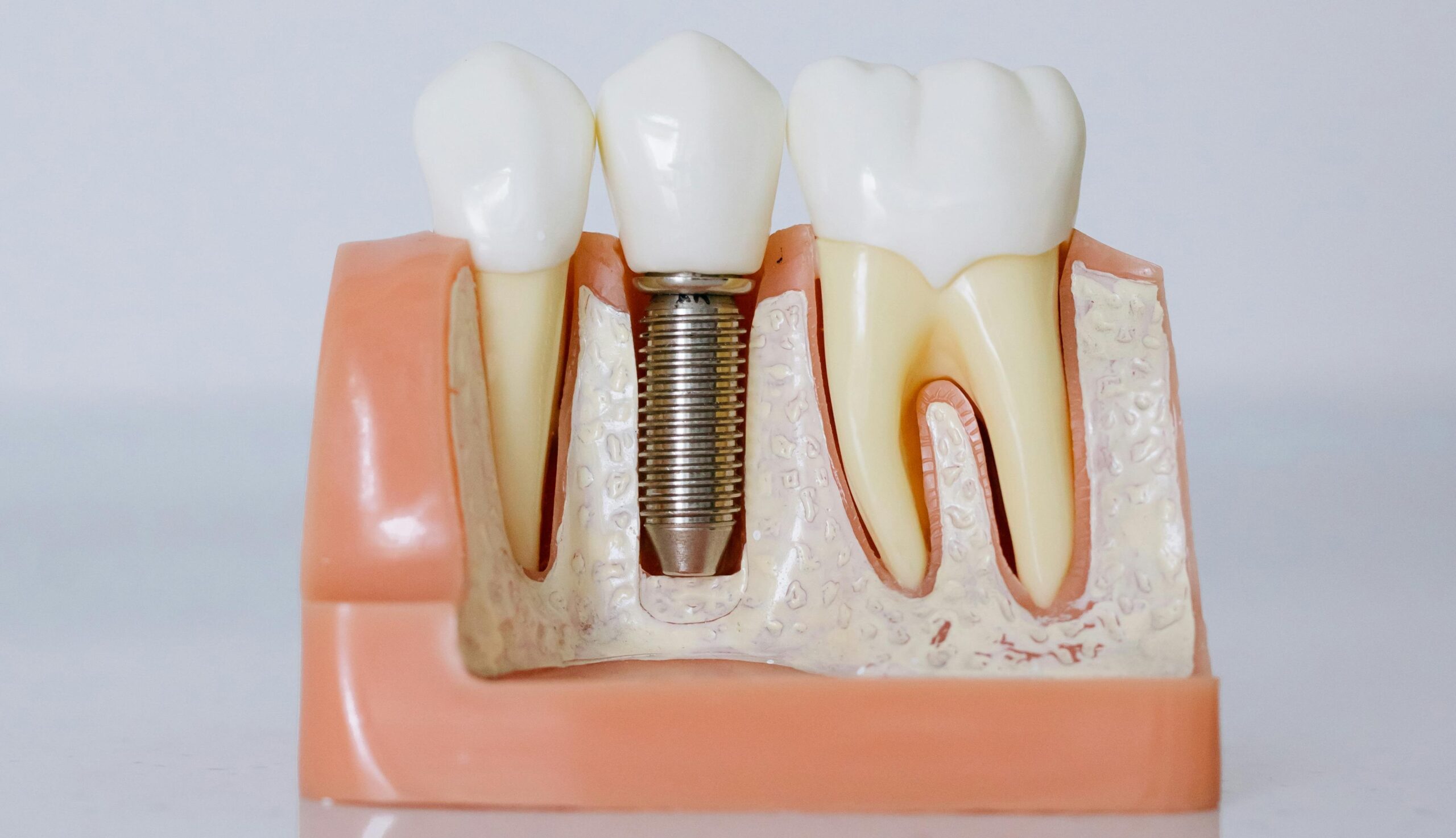 Lifecycle of a Tooth